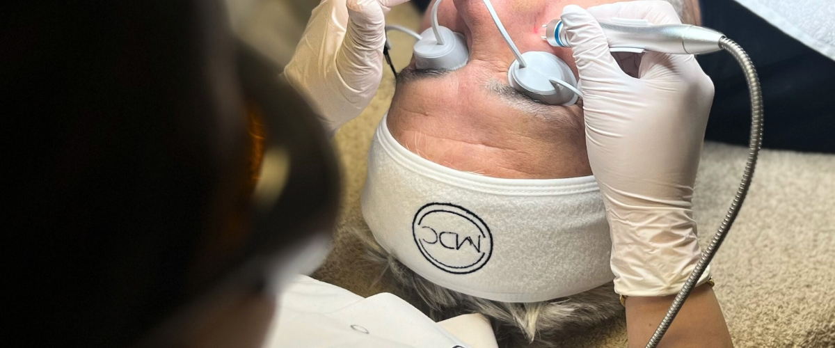 Laseren-van-pigmentvlekken