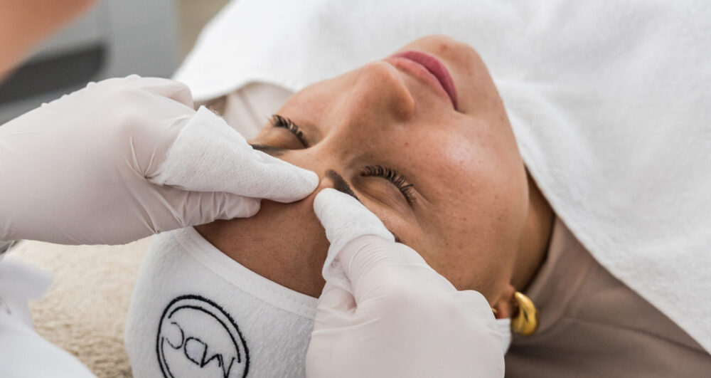 Renske Kleverwal Fotografie - Mei 2025 Medi Derma Clinic-94 Acnetherapie