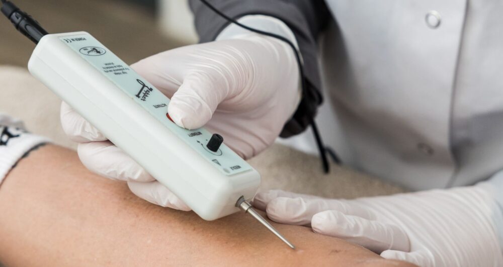 Coagulatietherapie Medi Derma Clinic Apeldoorn
