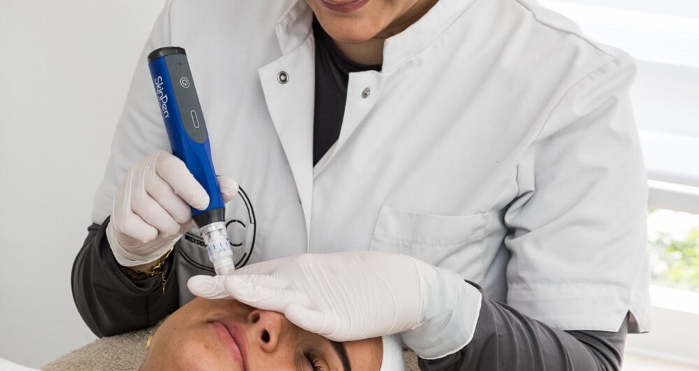 SkinPen Medische microneedling Apeldoorn
