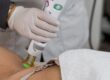 Is laserontharing permanent? Alles wat je moet weten