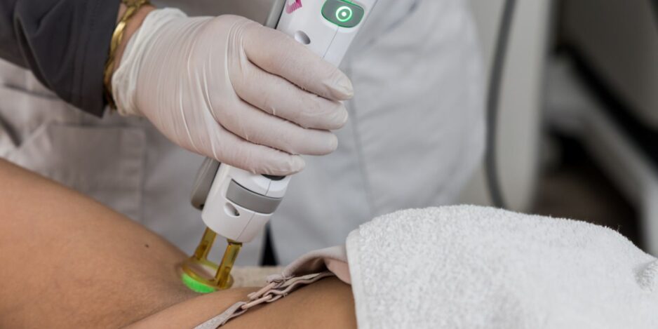 Is laserontharing permanent? Alles wat je moet weten