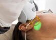Laserontharing van het gelaat bij Medi Derma Clinic in Apeldoorn
