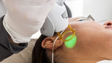 transgender-laserontharing-gelaat-apeldoorn Laserontharing van het gelaat bij Medi Derma Clinic in Apeldoorn
