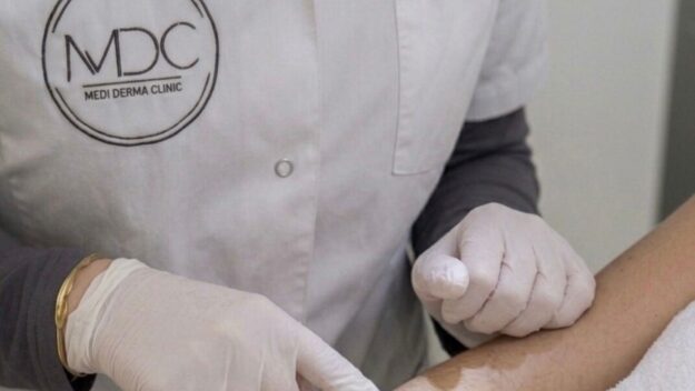 Laserontharing in het najaar bij Medi Derma Clinic in Apeldoorn